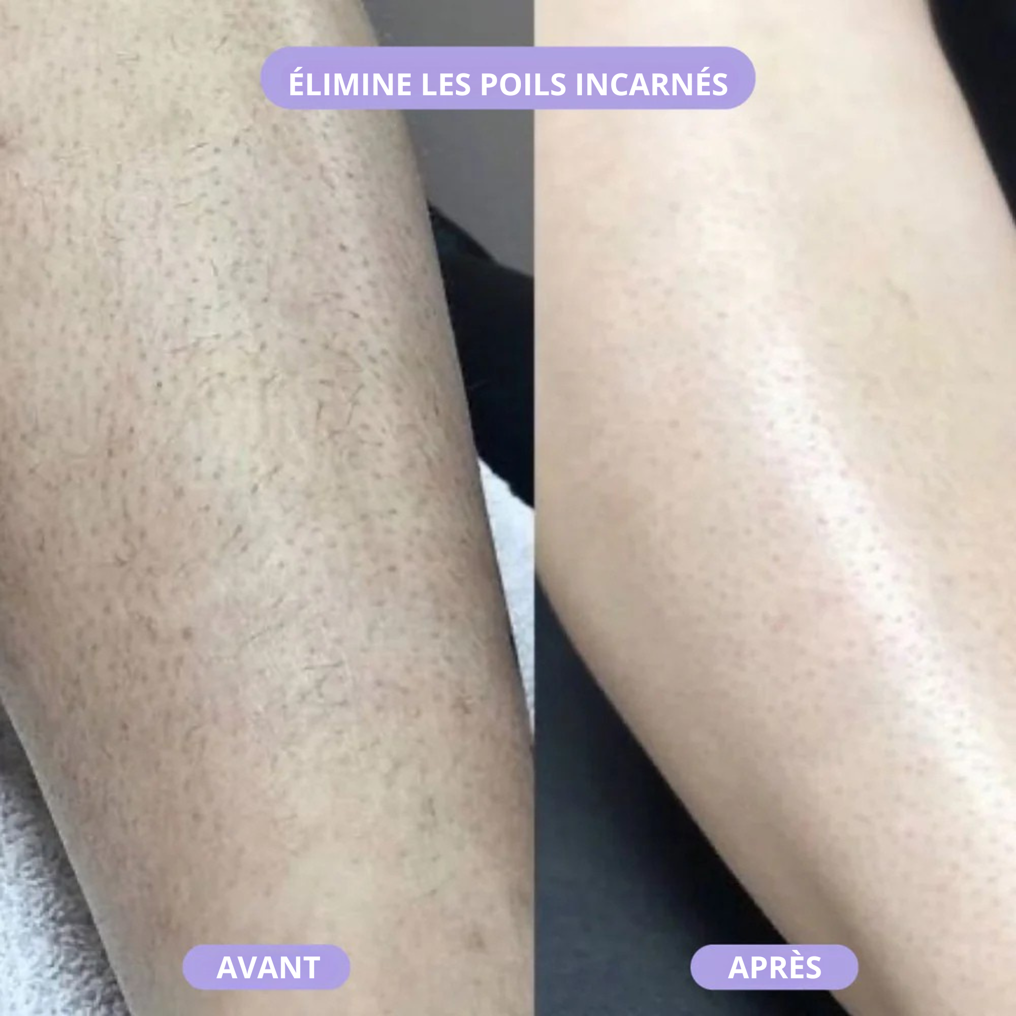 Furbace — La gomme dépilatoire pensée pour les femmes de La Réunion 🌺