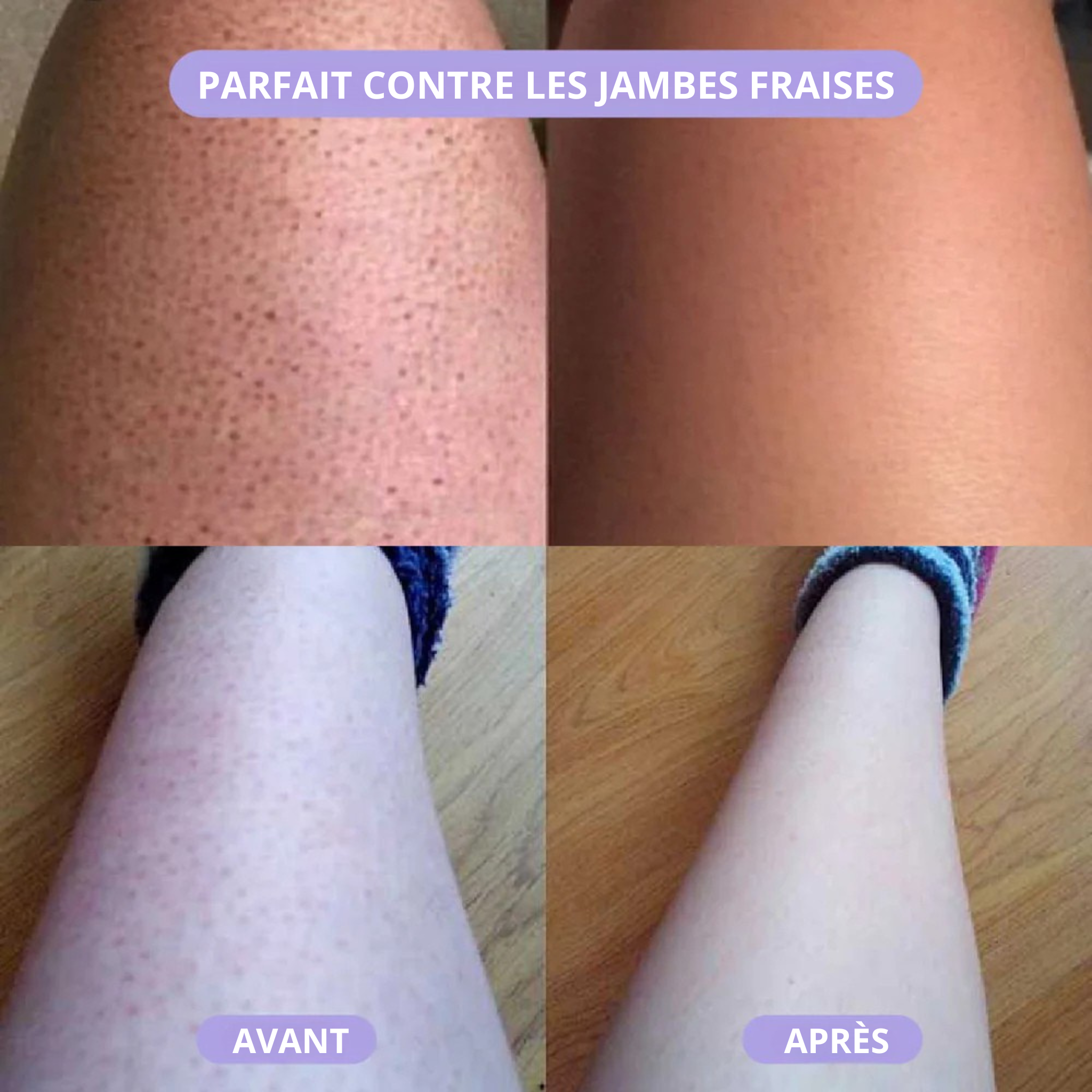 Furbace — La gomme dépilatoire pensée pour les femmes de La Réunion 🌺